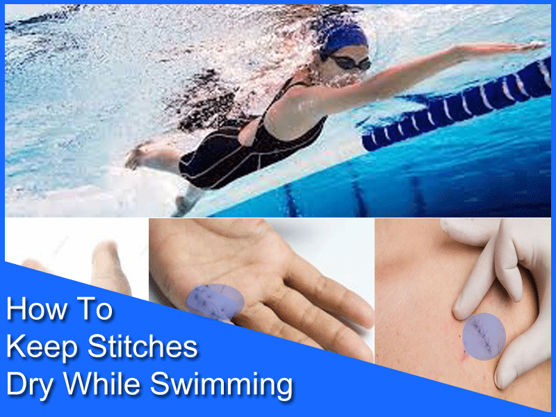 How To Keep Stitches Dry While Swimming